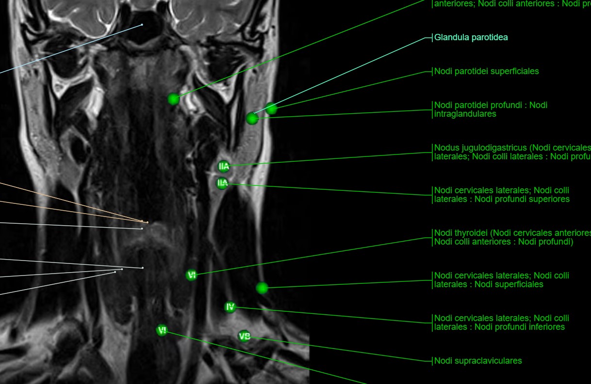 alle Lymphknoten Hals